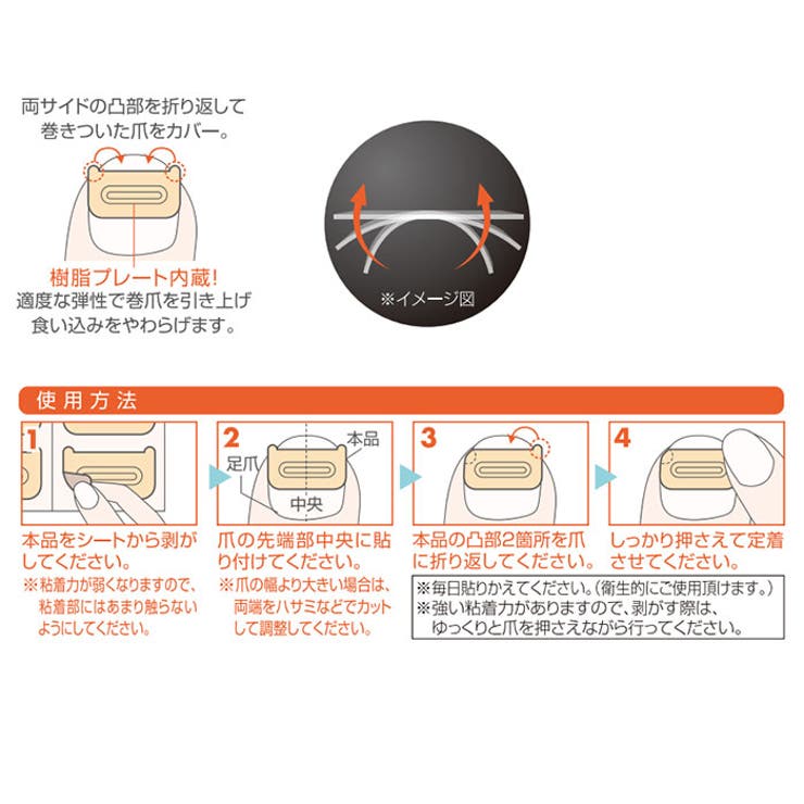 巻き爪