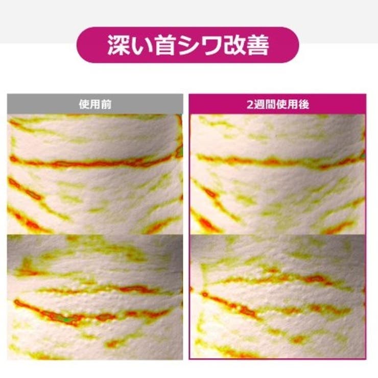 CKD レチノコラーゲン300Daネックカッサクリーム | bihibi | 詳細画像4 