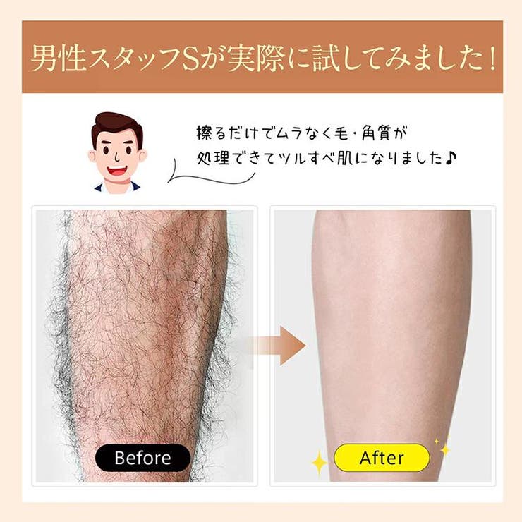 こするだけ！ガラス脱毛器 脱毛 除毛 | Emmmo | 詳細画像9 