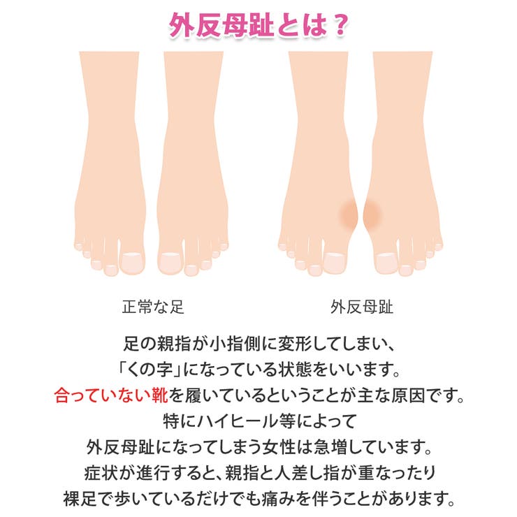 外反母趾 サポーター 親指 | shop kilakila | 詳細画像5 