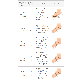 スクエアトゥ5連ストラップクリアヒールサンダル ストラップサンダル 編みサンダル | welleg | 詳細画像32 