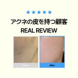 【ニキビケアセット】ニキビ皮脂調節アンプル75ml+クリーム50ml 韓国コスメ 韓国 | VICLE | 詳細画像4 
